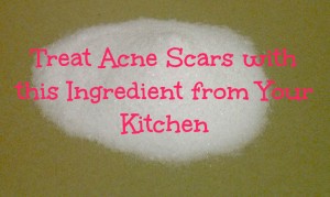 baking soda for microdermabrasion